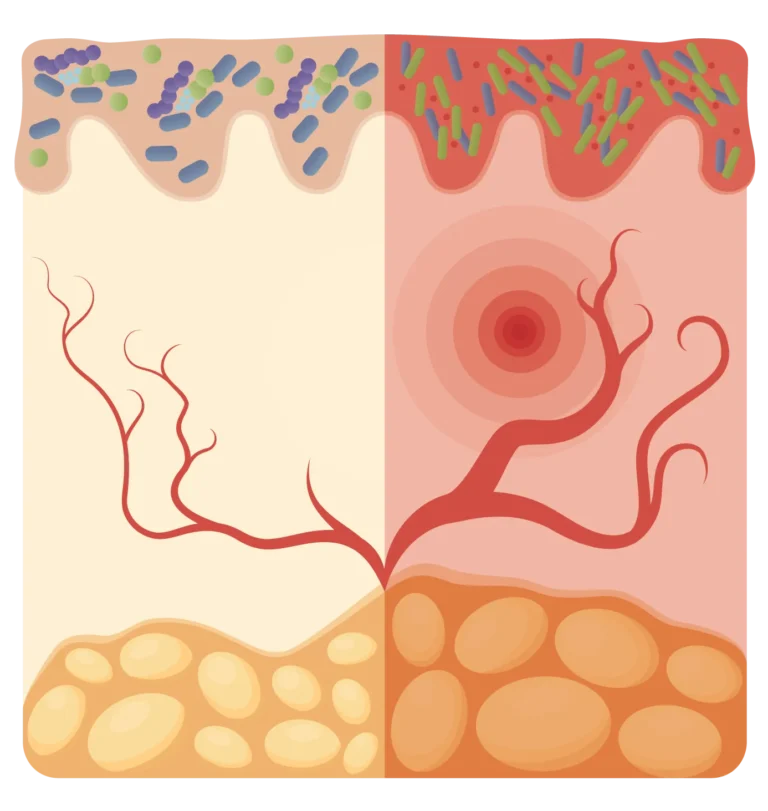 Skin Quality and Skin Appearance