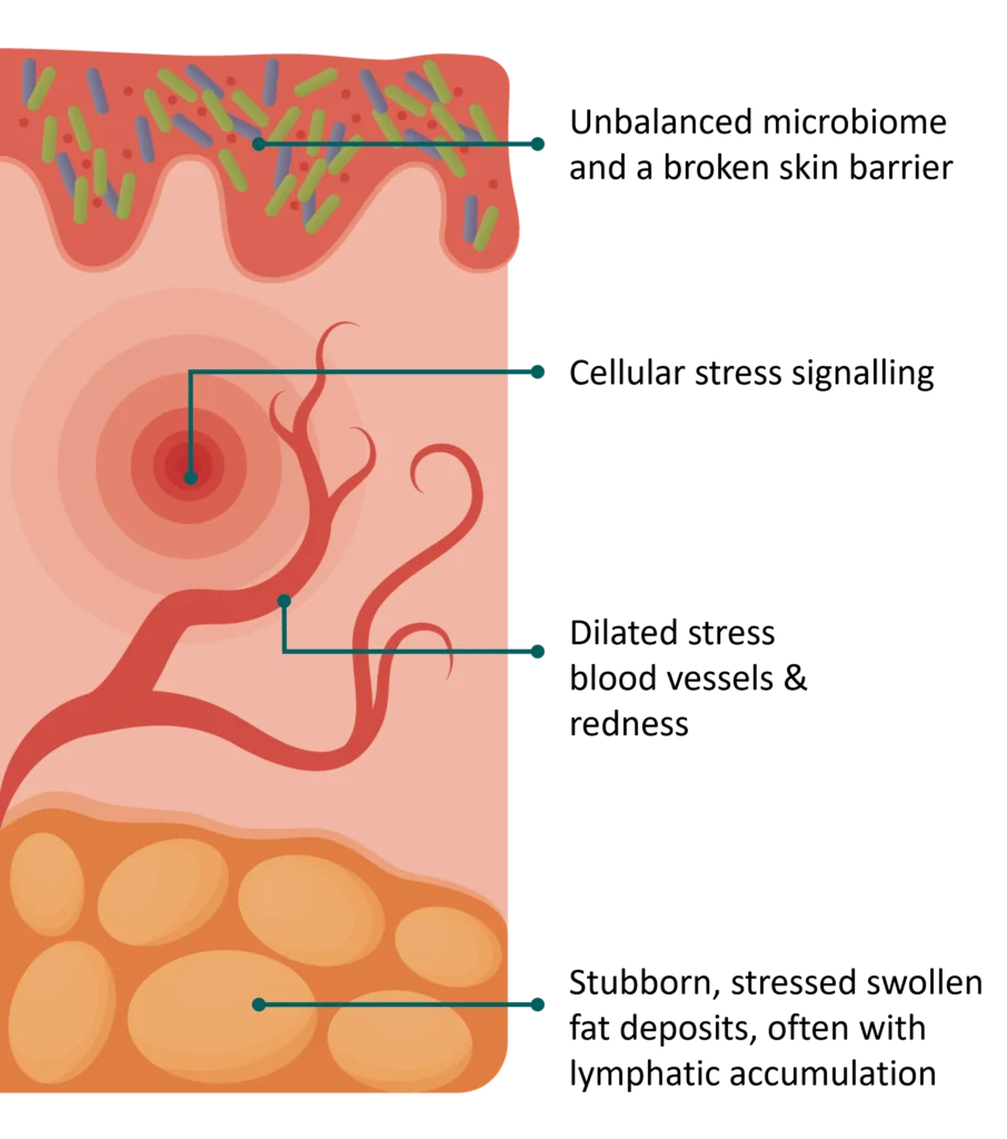 SkinStress Sources 1