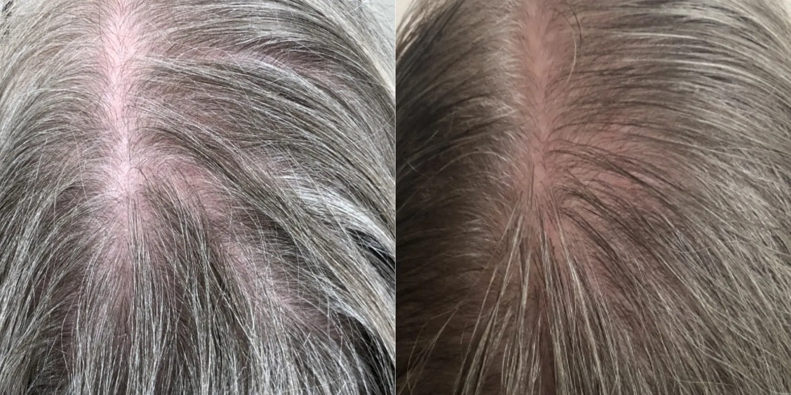 Best Treatments for Hair and Scalp Health