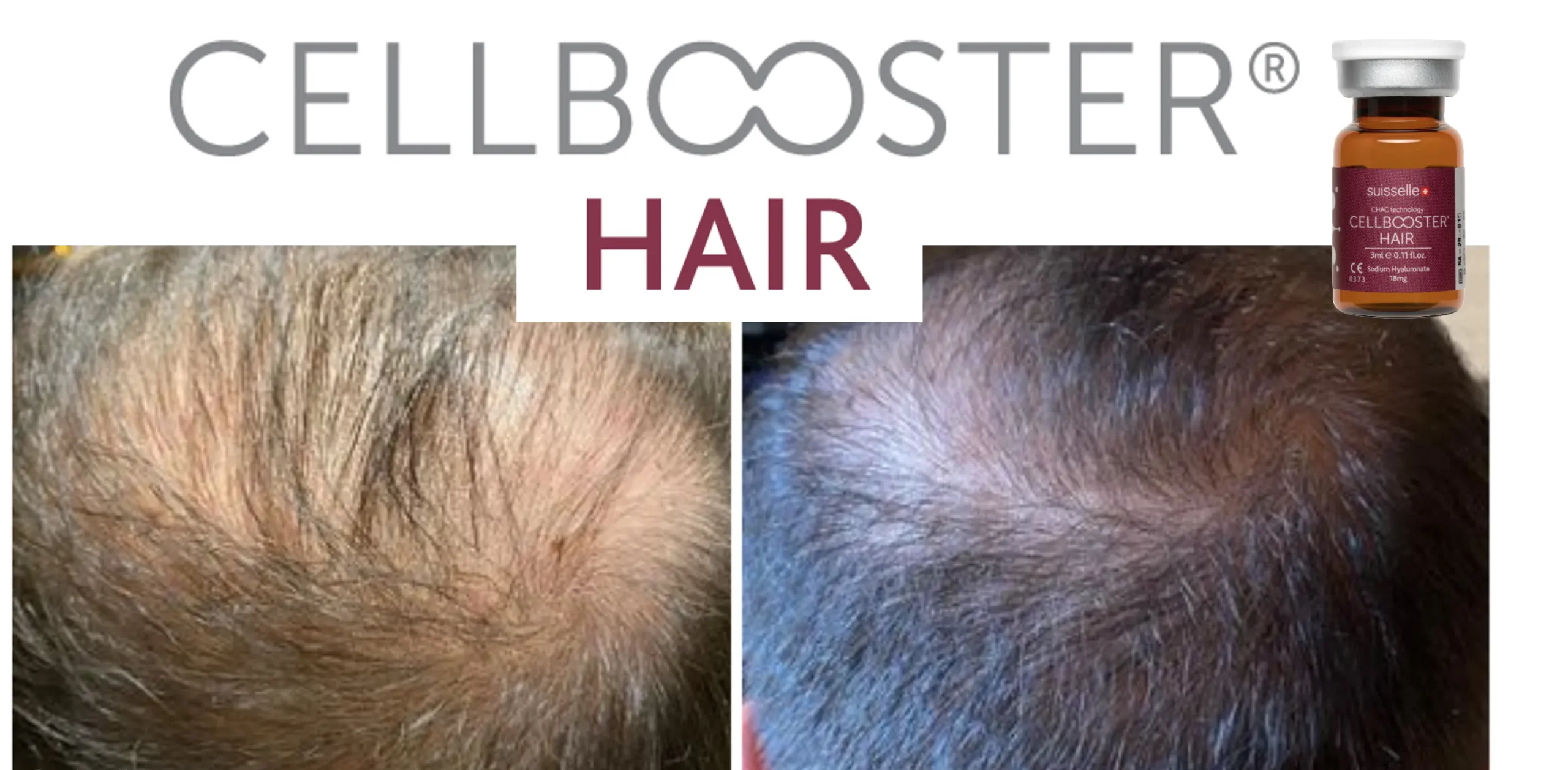 Cellbooster Hair scaled